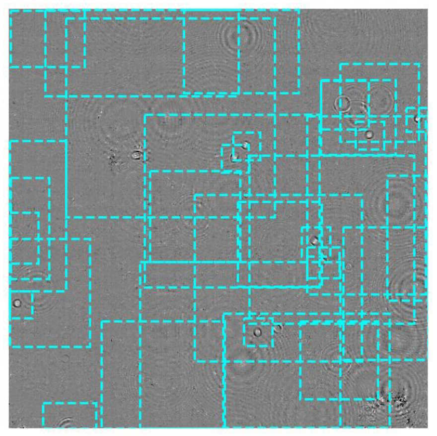 Image of bounding boxes around pathogens in a DHM image